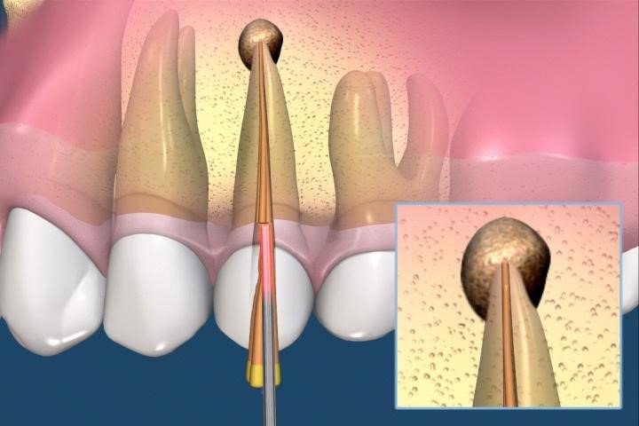 Ortho-Extend - cabinet stomatologic